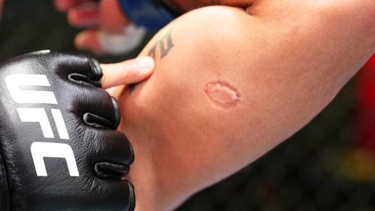 Mmabite